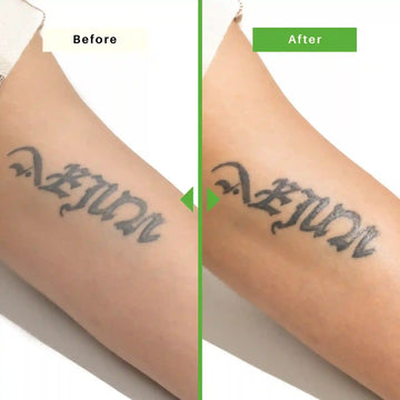 Before and after comparison of a tattoo on a person's arm with a green dividing line.